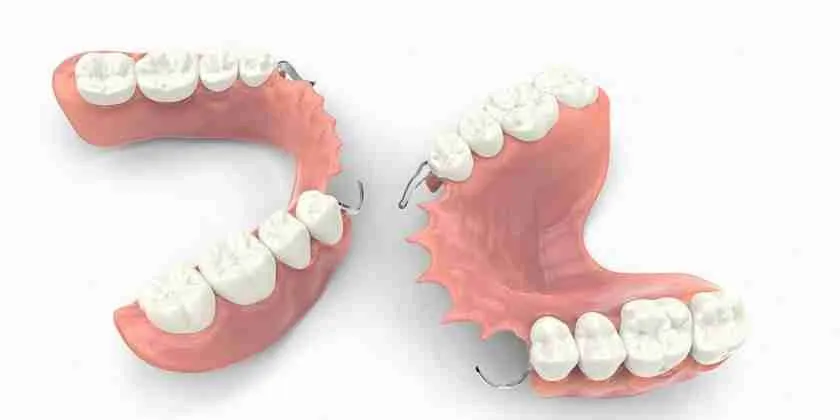 Partial Implant Dentures in Chennai