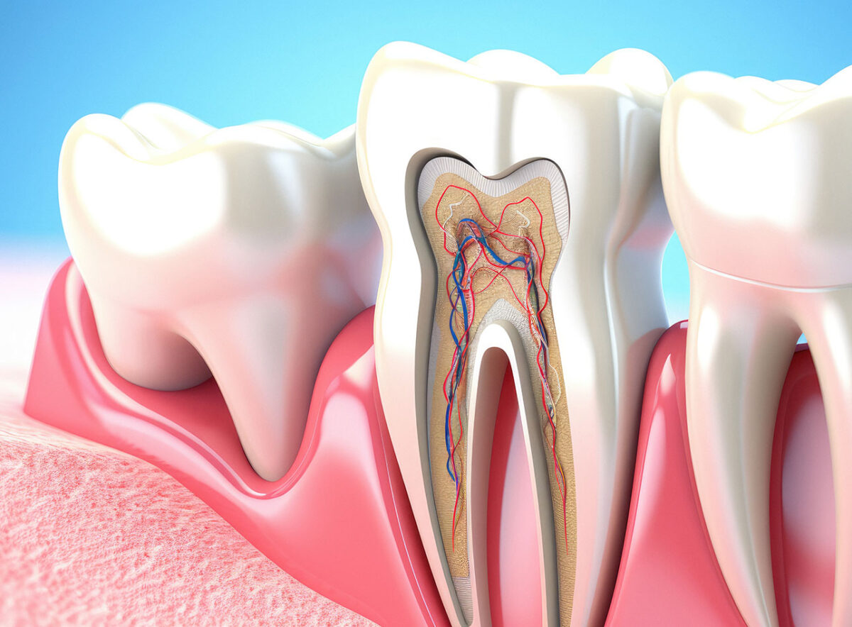 Root Canal Treatment , Root Canal Treatment Specialist near Chennai,