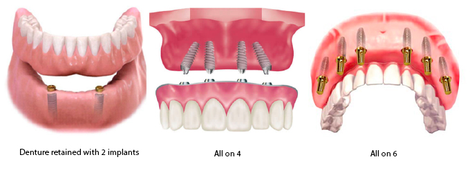 Best Dental Hospital In Chennai