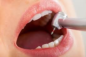 Root Canal Treatment Specialist near Villivakkam, Mogappair