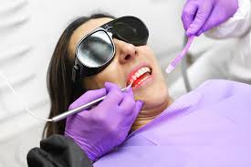 Best Laser Dental Clinic Chennai