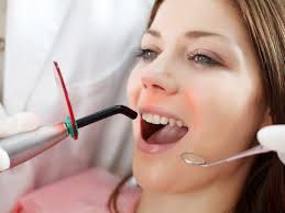 Laser Dentistry Near Villivakkam, Mogappair, Chennai