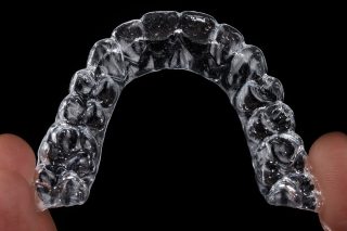 Clear Aligners