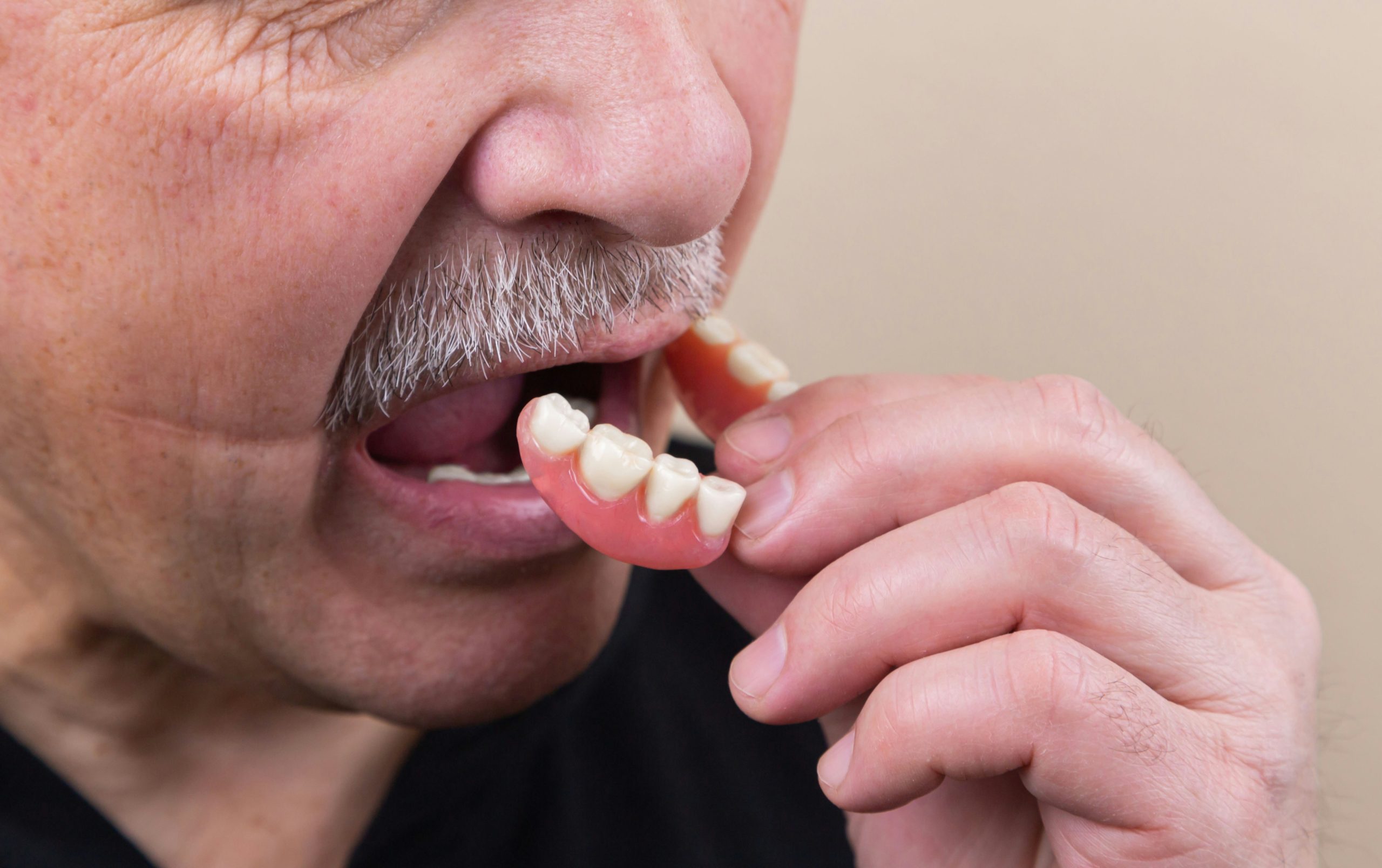 Best Implantologist In Chennai | Best Dental Hospital In Chennai
