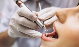 The Role of Root Canals in Preventing Tooth Loss