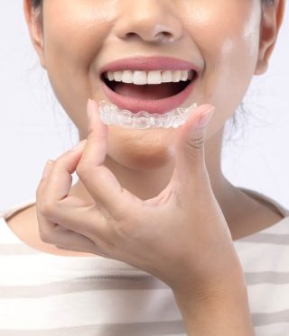 All You Should Know About Invisible Braces
