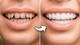 Top Benefits of Choosing Dental Tourism for Your Smile Makeover