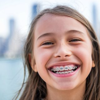 Best Age to Start Braces for Children: A Guide for Parents